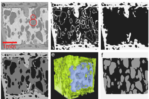 Assessment of Bone Ingrowth into Porous Biomaterials Using Micro-CT